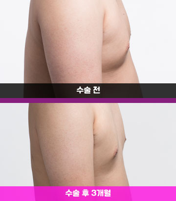 장비
