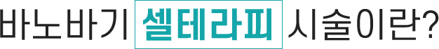 바노바기 셀테라피 시술이란?