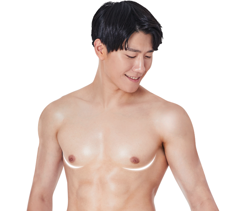 여성형유방 수술 환자