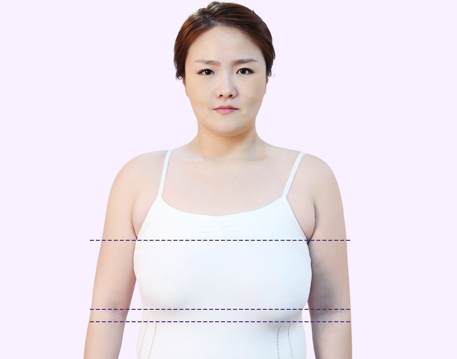 비대칭 가슴 이미지
