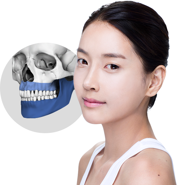 양악 수술은 턱의 구조를 바로잡는 수술입니다