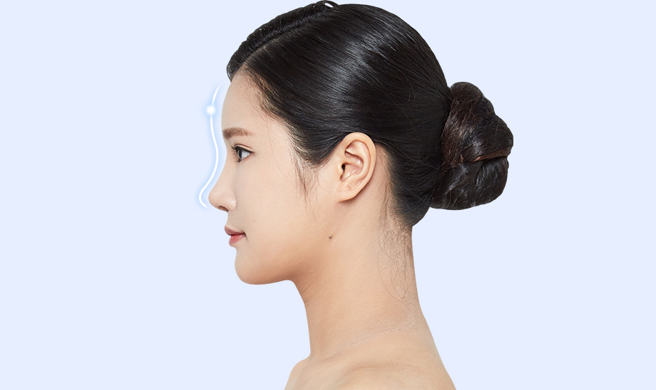 밋밋하고 꺼진 이마, 볼륨이 필요합니다