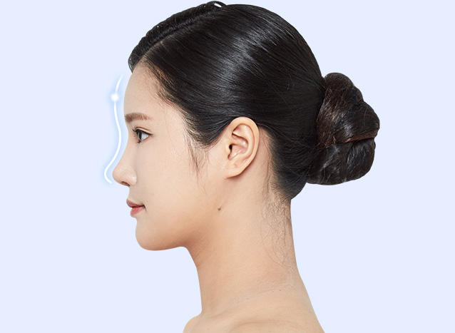 밋밋하고 꺼진 이마, 볼륨이 필요합니다