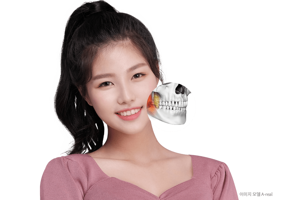 바노바기 성형외과 성형모델