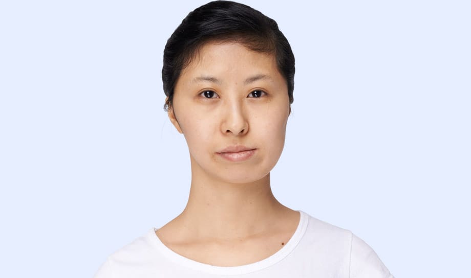 비대칭 교정 성형 모델