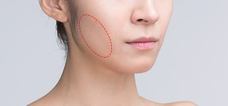 근육, 지방과 같은 조직들이 비대칭인 경우