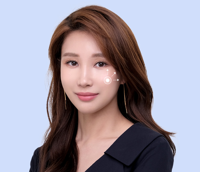 바노바기 성형외과 광대수술 성형모델