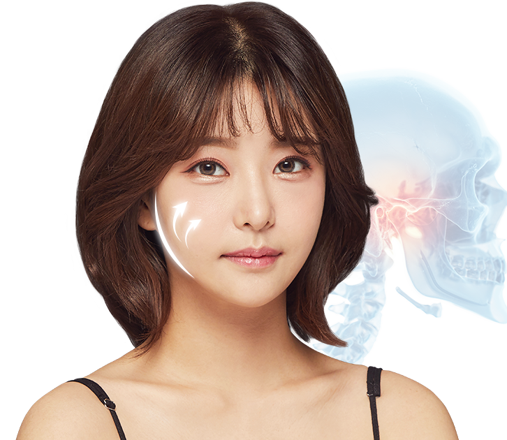 바노바기 성형외과 광대 성형모델
