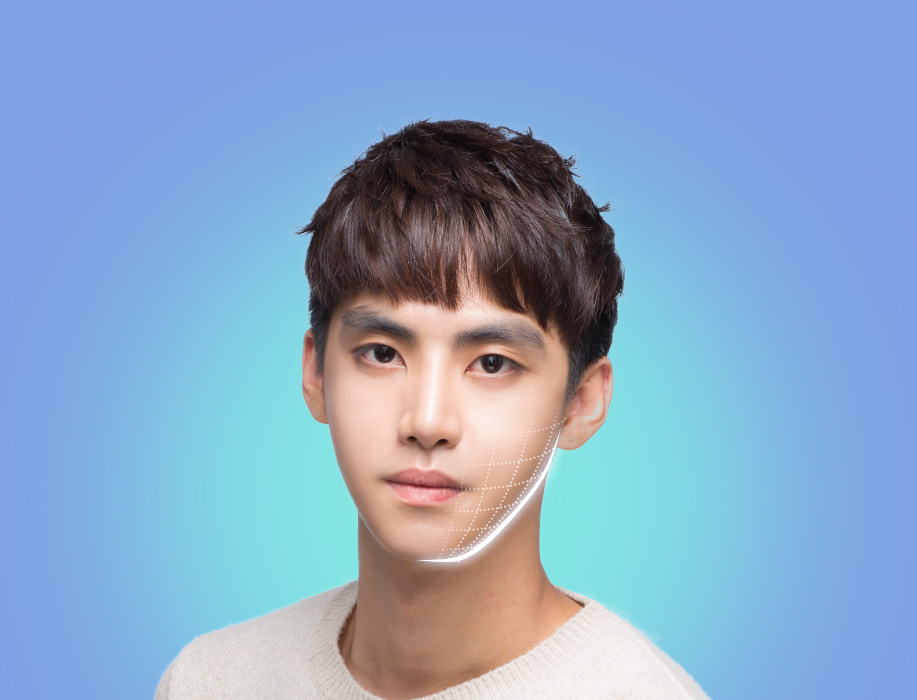 바노바기 성형외과 성형모델