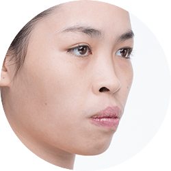 부자연스러운 얼굴 비율