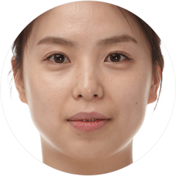 팔자주름, 턱 끝 주름 등 노안