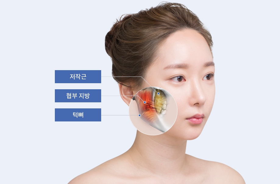 저작근-협부지방-턱뼈