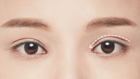다양하게 구현할 수 있는 쌍꺼풀 라인 - 아웃라인