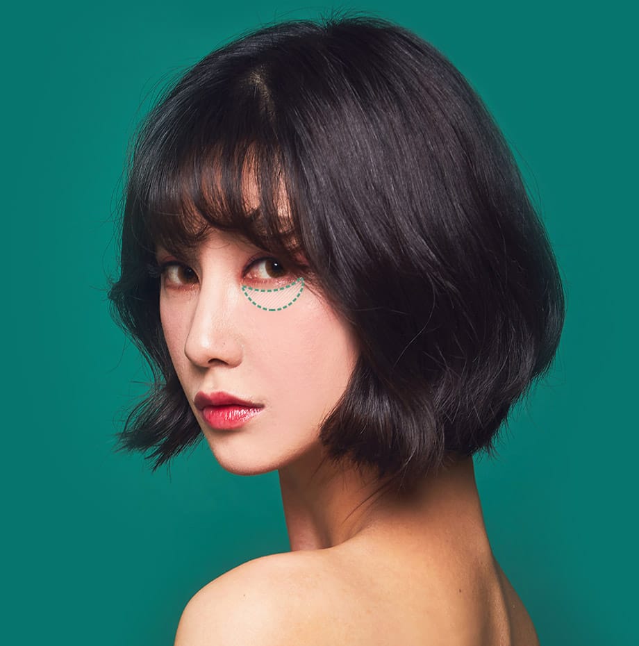 바노바기 성형외과 눈 성형모델