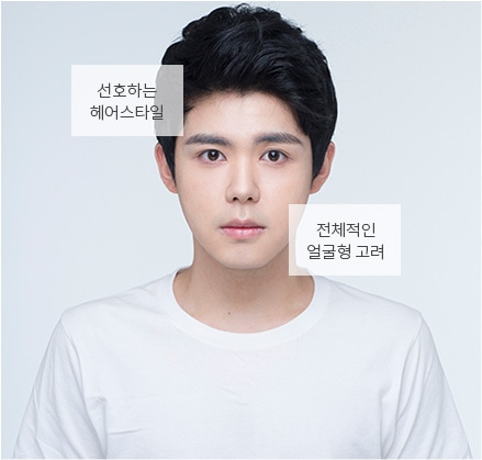 이마 주름이 심한 경우