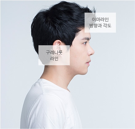 콧잔등과 눈가 주름이 심한 경우