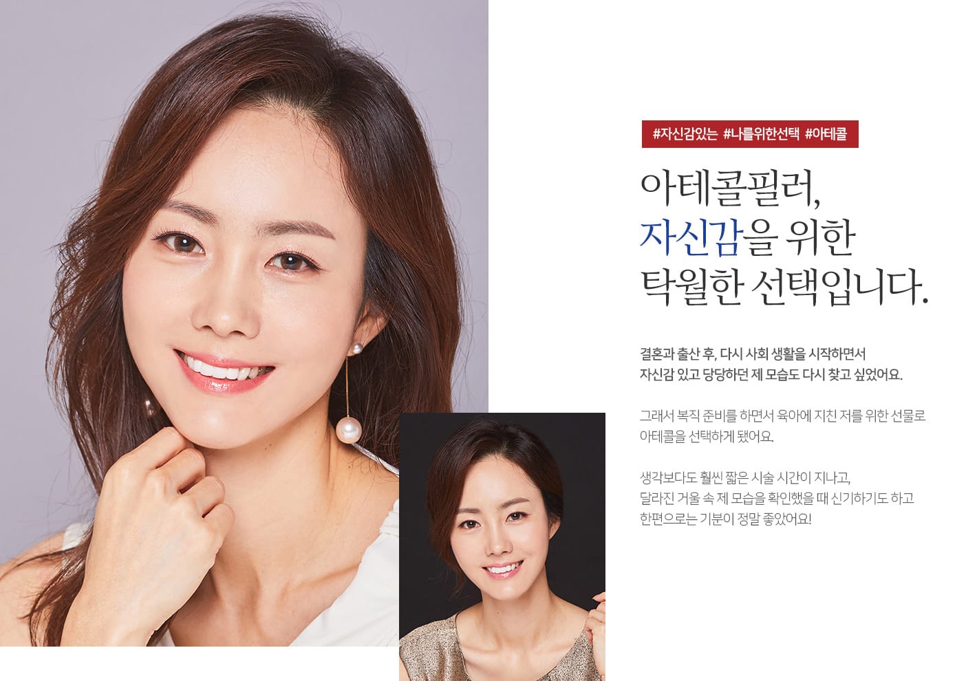 #자신감있는 #나를위한선택 #아테콜 아테콜필러, 자신감을 위한 탁월한 선택입니다.