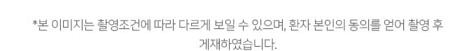 본 이미지는 촬영조건에 따라 다르게 보일 수 있으며, 환자 본인의 동의를 얻어 촬영 후 게재하였습니다.