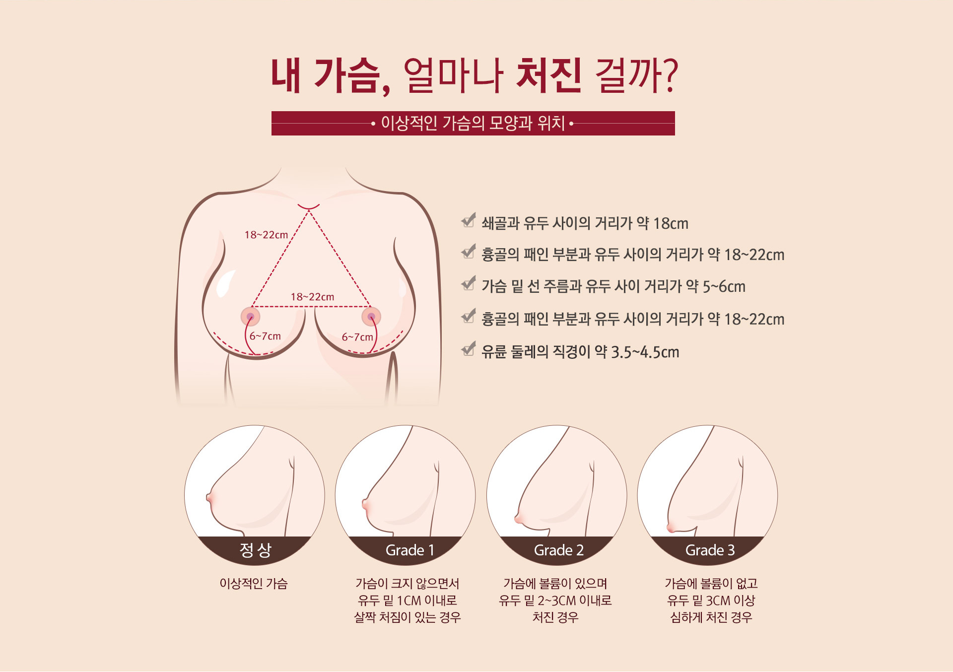 내 가슴, 얼마나 처진 걸까? 이상적인 가슴의 모양과 위치