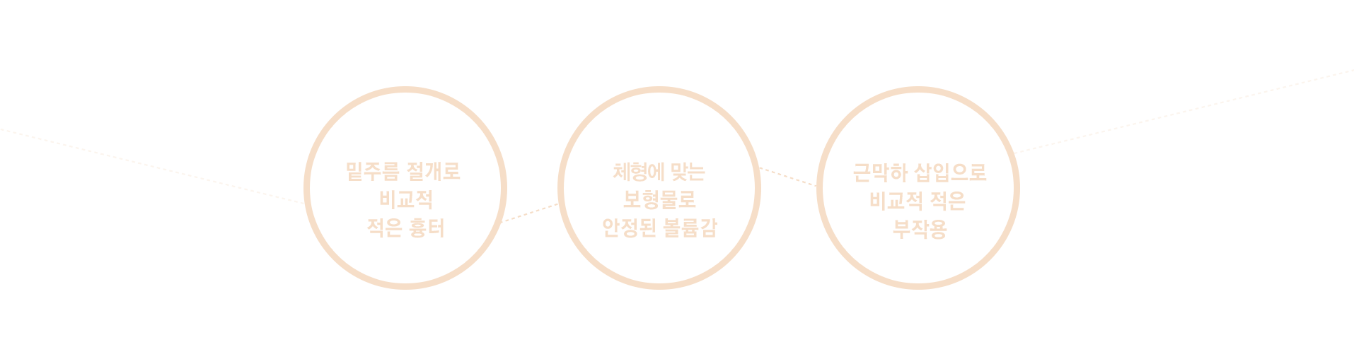 밑주름 절개로 비교적 적은 흉터, 체형에 맞는 보형물로 안정된 볼륨감, 근막하 삽입으로 비교적 적은 부작용