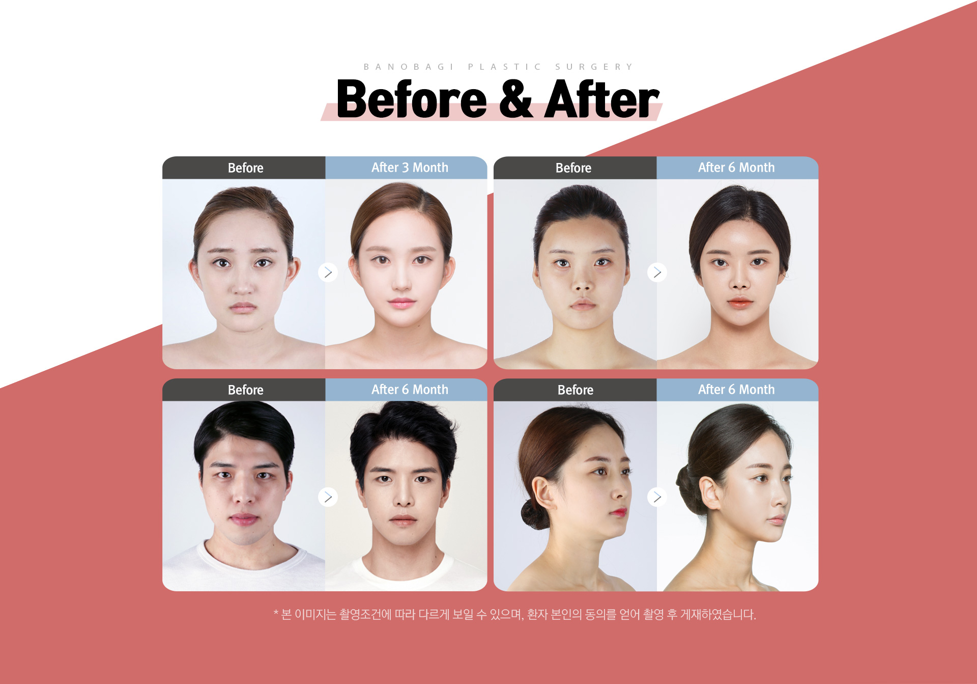Before & After