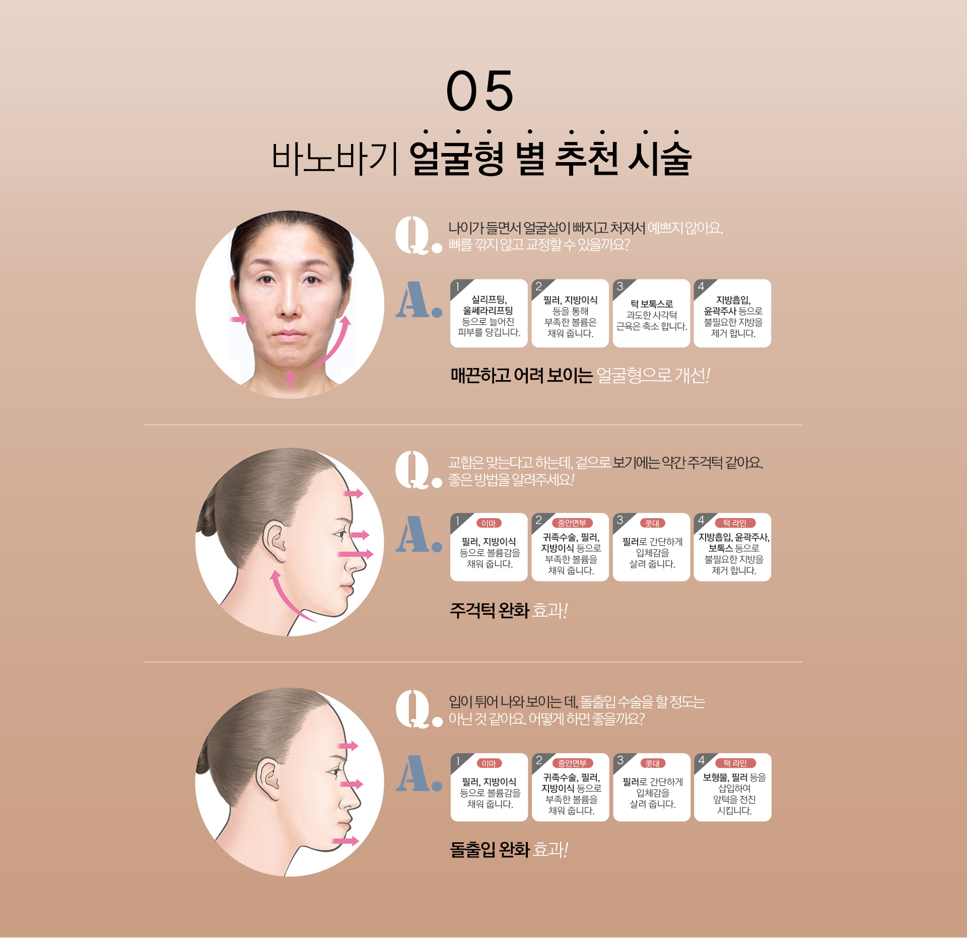 05 - 바노바기 얼굴형 별 추천 시술
