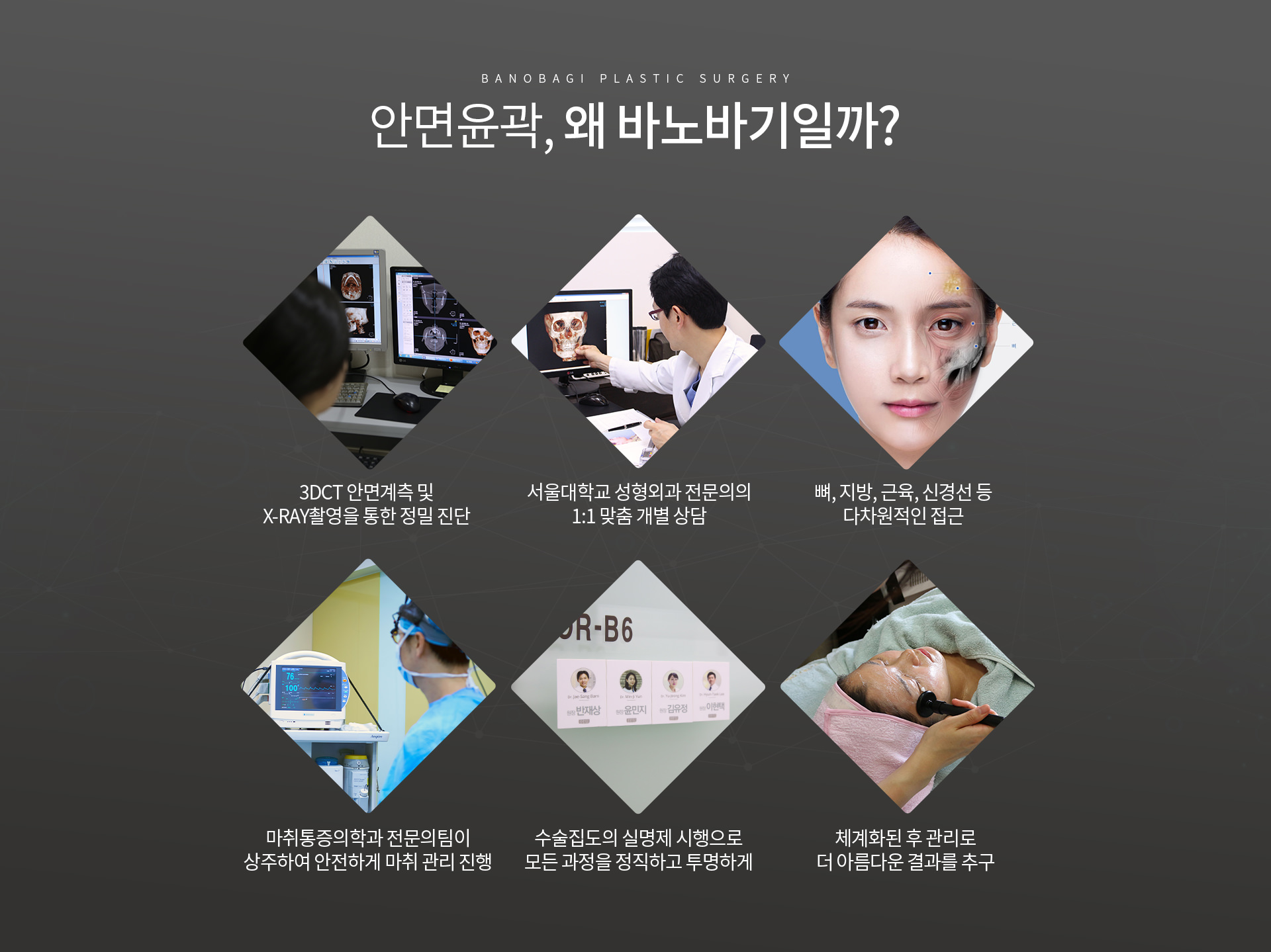 안면윤곽, 왜 바노바기일까?