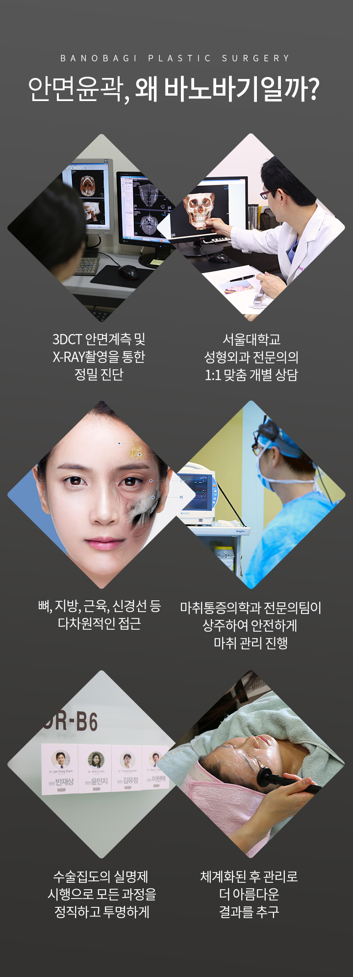 안면윤곽, 왜 바노바기일까?