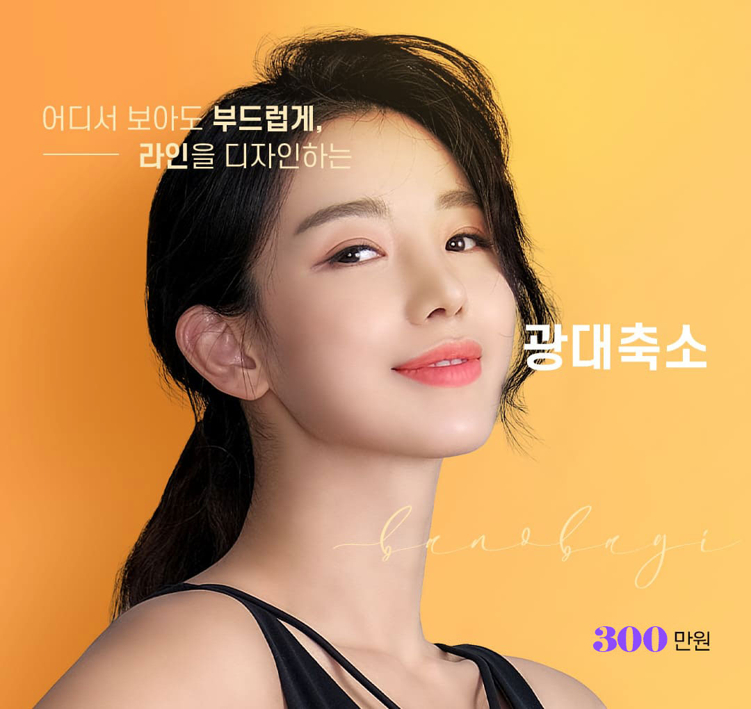 광대축소 재배치
