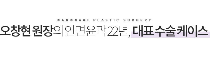 오창현 원장의 안면육곽 19년, 대표 수술 케이스