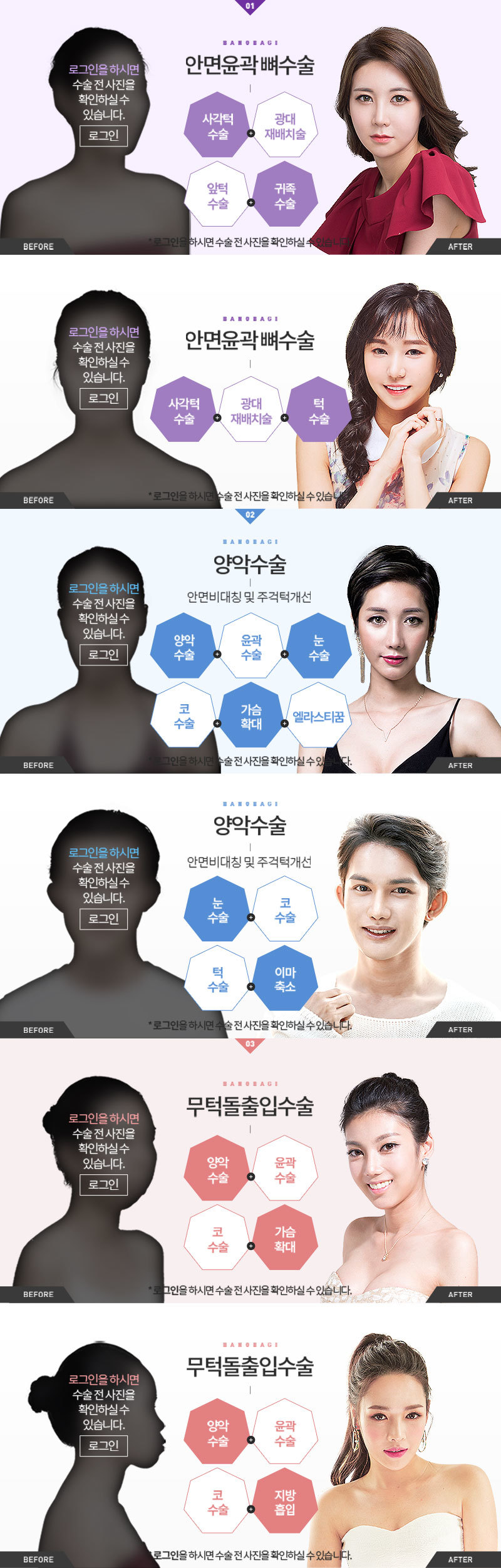 before,after