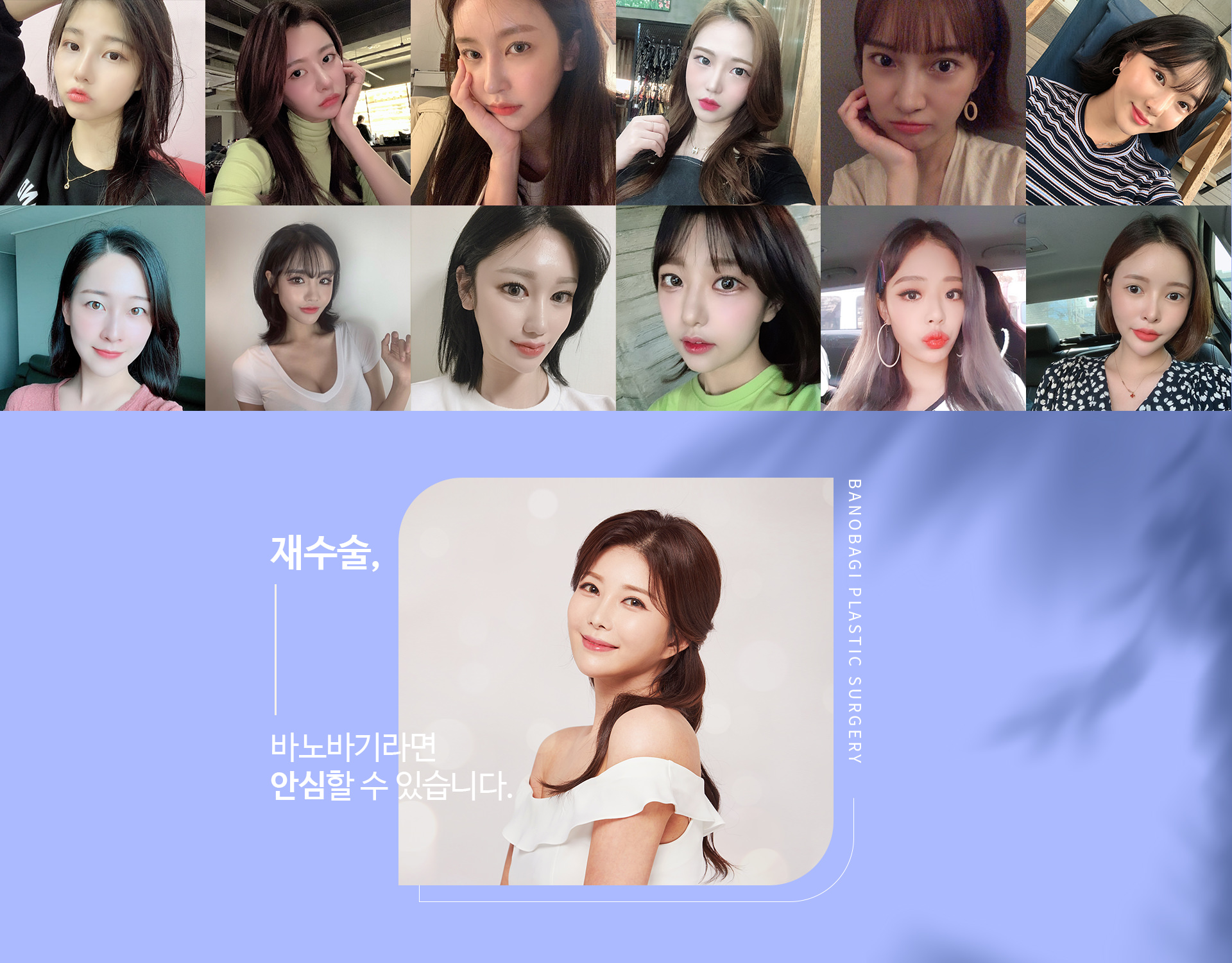 재수술, 바노바기라면 안심할 수 있습니다.