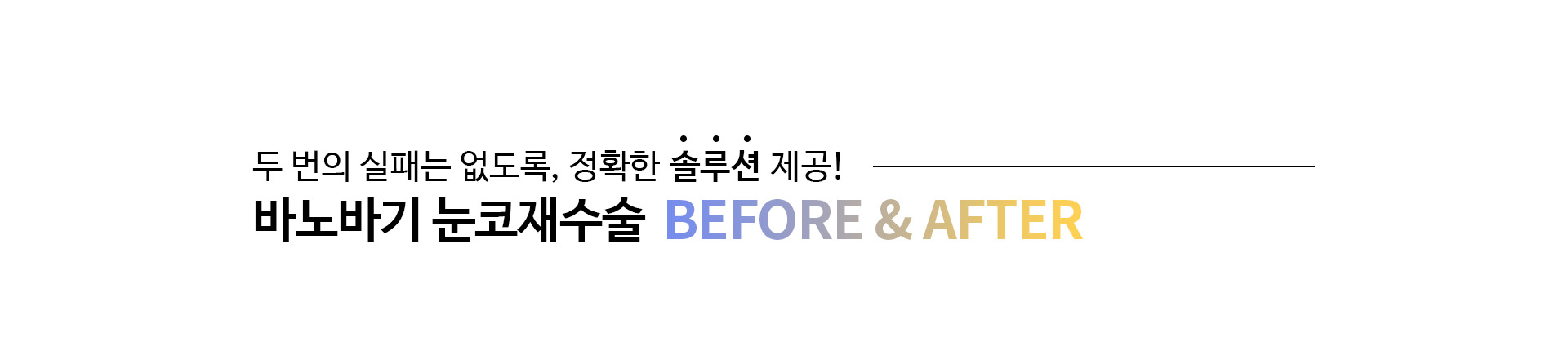 두 번의 실패는 없도록, 정확한 솔루션 제공! 바노바기 눈코재수술 BEFORE & AFTER