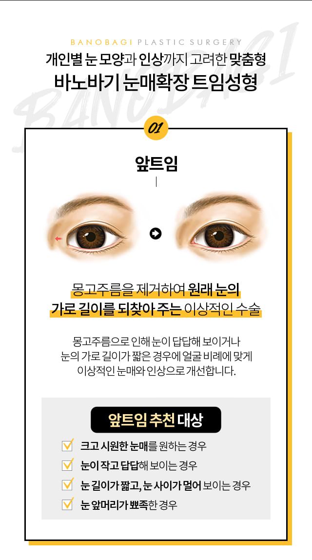 앞트임 추천대상