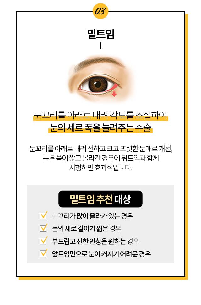 밑트임 추천대상