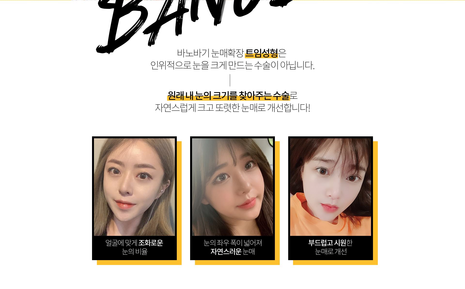 원래 내눈의 크기를 찾아주는 수술