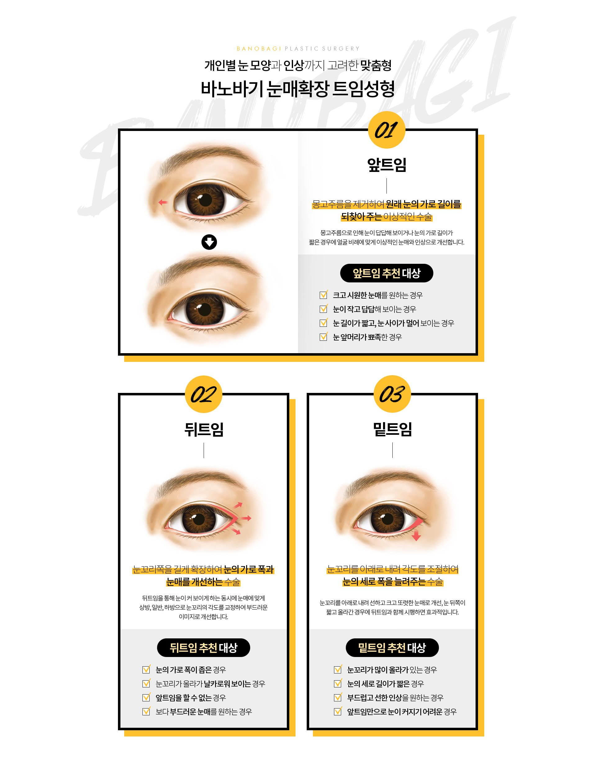 개인별 눈모양과 인상까지 고려한 맞춤형