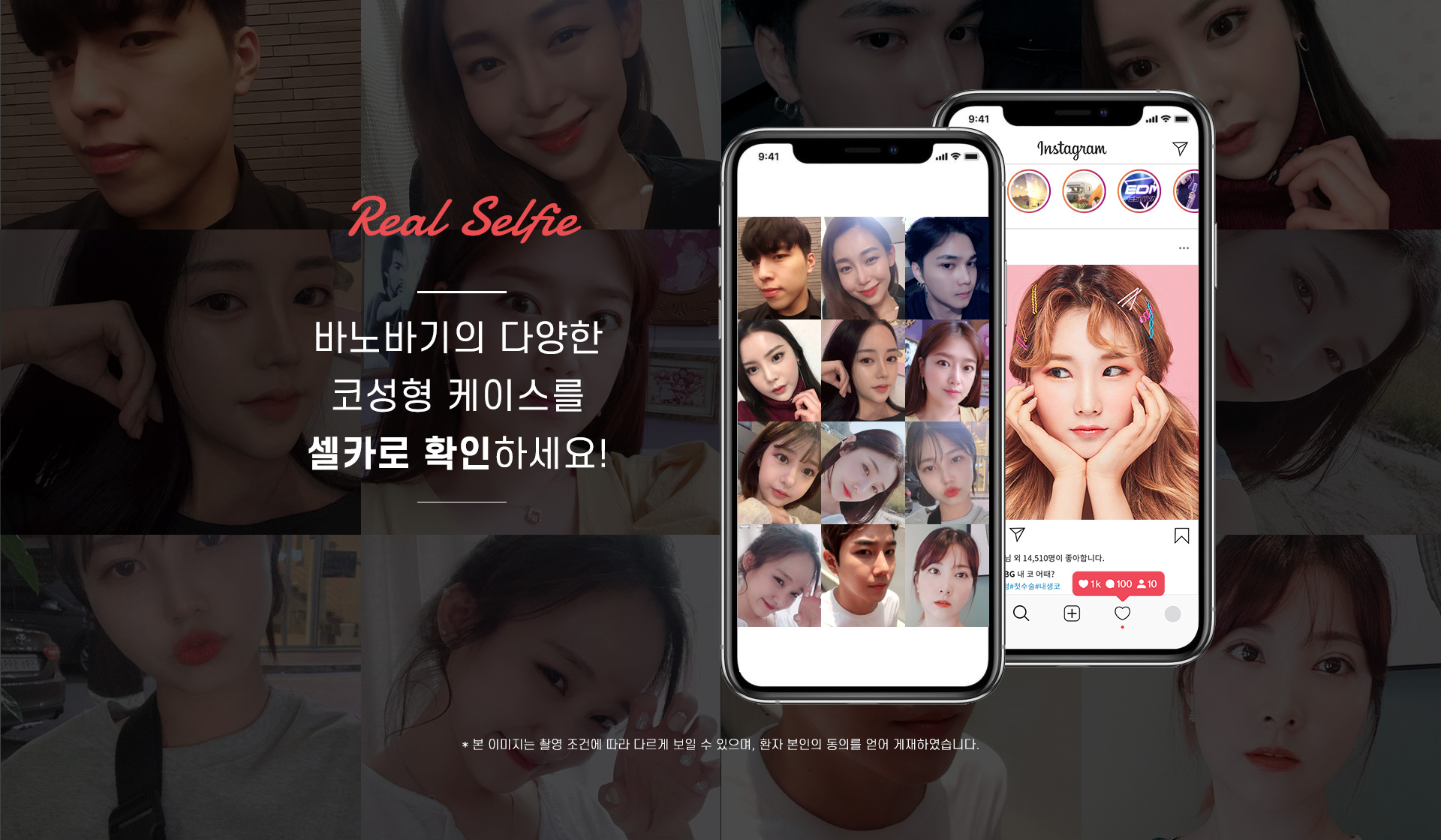 바노바기의 다양한 코성형 케이스를 셀카로 확인하세요!