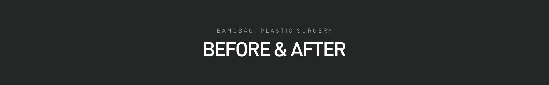 BEFORE & AFTER