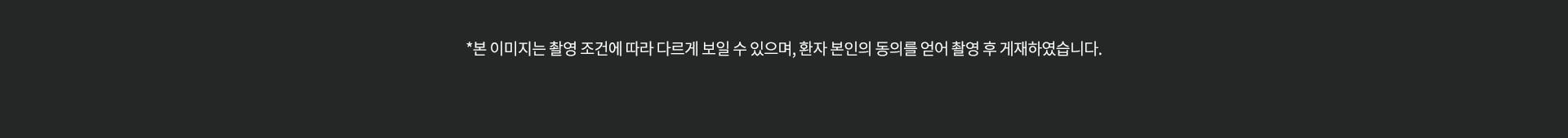 본 이미지는 촬영조건에 따라 다르게 보일 수 있으며, 환자 본인의 동의를 얻어 촬영 후 게재하였습니다.