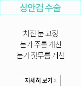 상안검 수술:처진 눈 교정, 눈가 주름 개선, 눈가 짓무름 개선