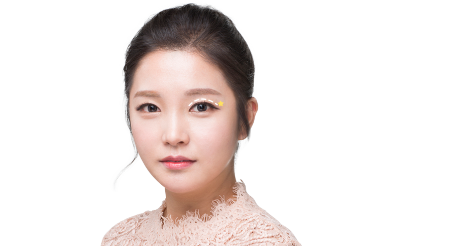 바노바기 성형외과 성형모델