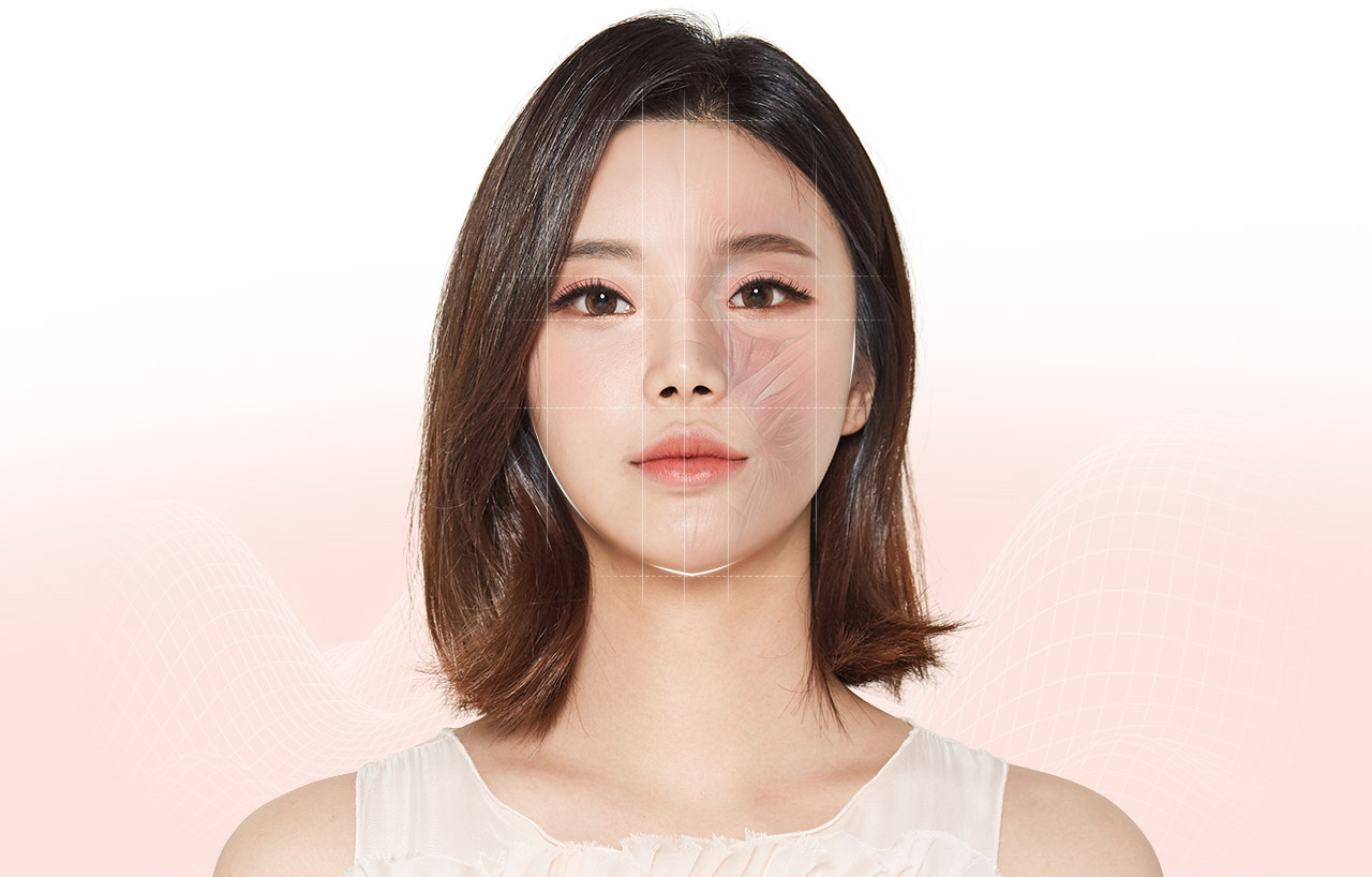 윤곽 재수술 모델