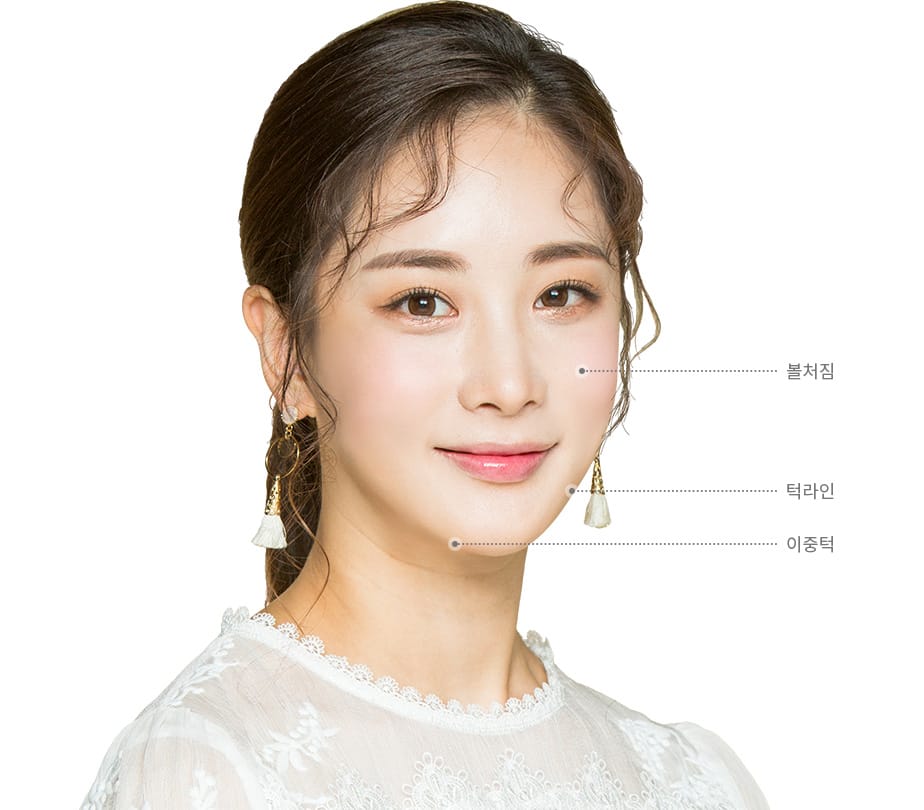 탄력리프팅 시술 환자