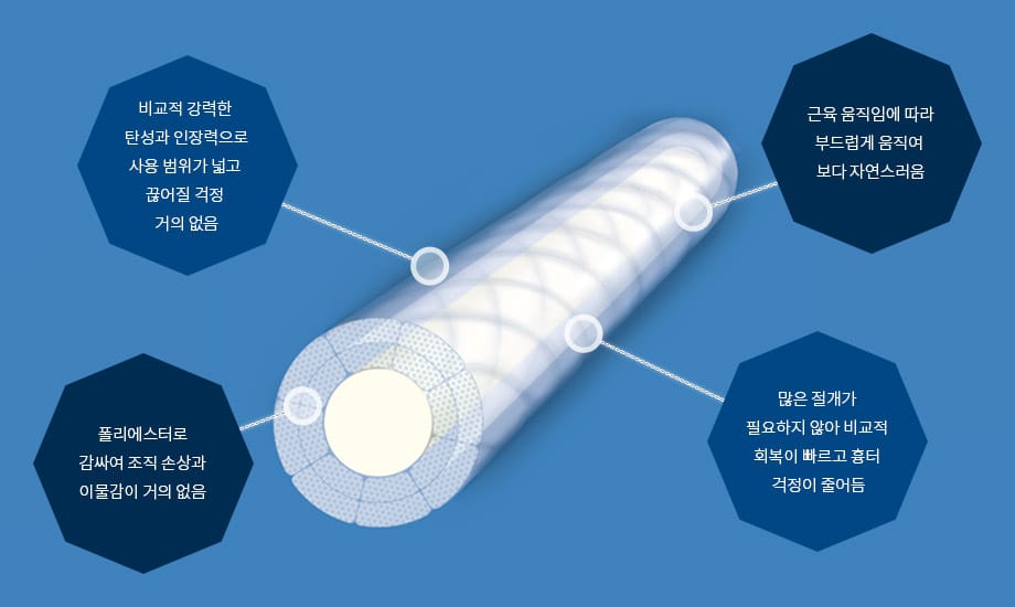 비교적 강력한 탄성과 인장력으로 사용 범위가 넓고 끊어질 걱정 거의 없음, 근육 움직임에 따라 부드럽게 움직여 보다 자연스러움, 폴리에스터로 감싸여 조직 손상과 이물감이 거의 없음, 많은 절개가 필요하지 않아 비교적 회복이 빠르고 흉터 걱정이 줄어듬