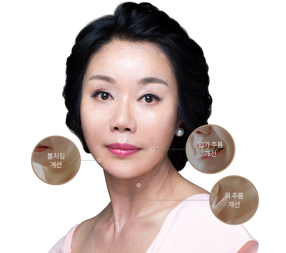 안면거상술 시술 환자