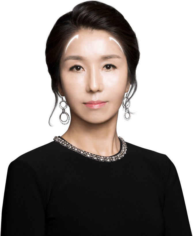 이마를 전반적으로 당겨주는 내시경 이마 리프팅