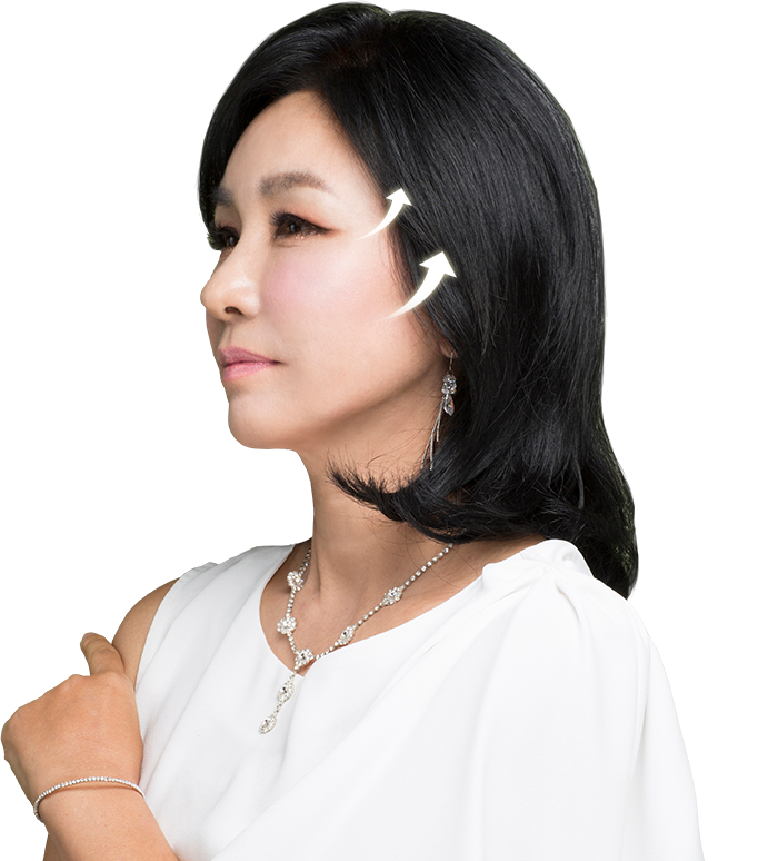 바노바기 성형외과 동안 성형모델